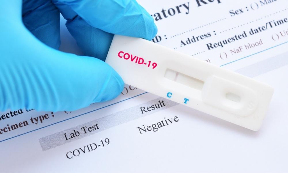 ¿Por qué si ya estoy vacunado contra el Covid 19 no se registran antígenos en mi prueba?