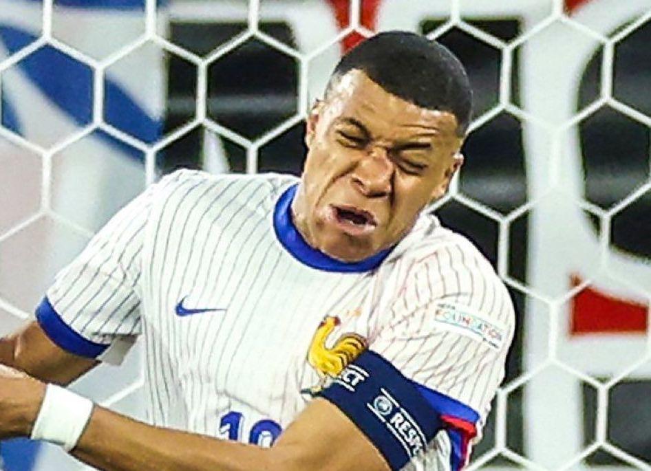 Mbappé se fractura la nariz durante un partido de la euro 