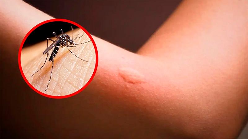¡Cuidado! El dengue llegaría al 70% del territorio de México