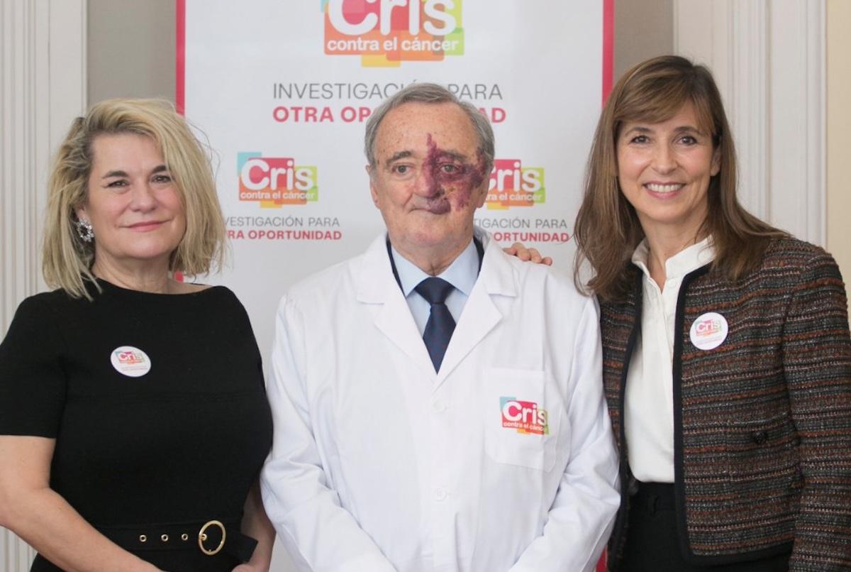 ¿En qué consiste la triple terapia para atacar el cáncer de páncreas?