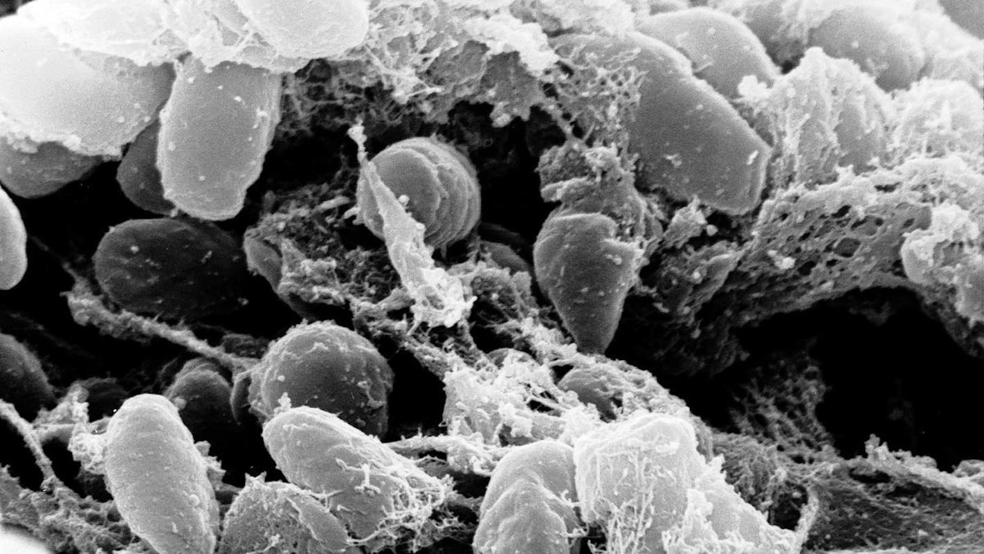 Se activa alerta mundial por presunto brote de peste pulmonar