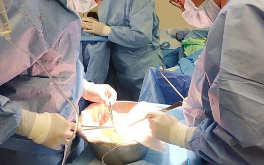 Especialistas del Issste realizan trasplante de riñón en Hospital Regional “Dr. Valentín Gómez Farías”